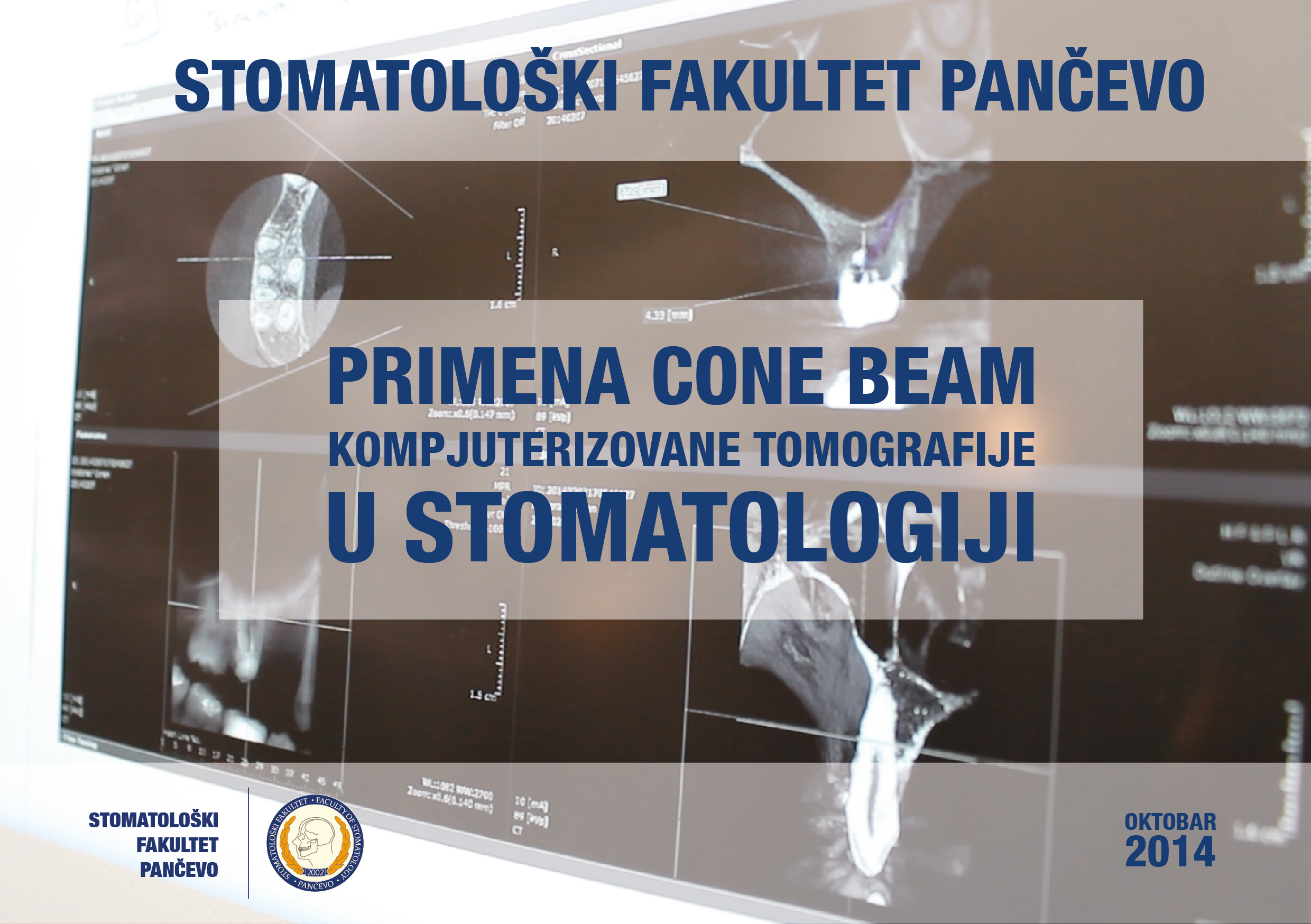 Primena CBCT u stomatologiji